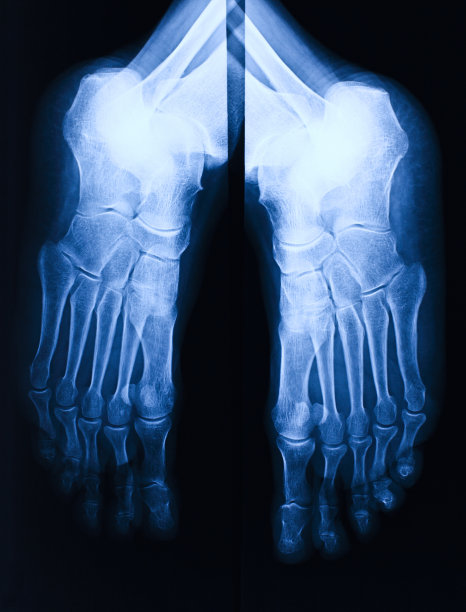 人类脚的x射线图像图片下载