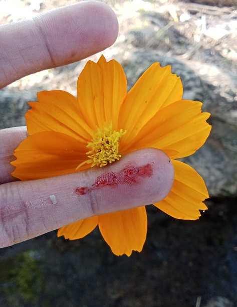 一个被抓伤流血的手指图片下载