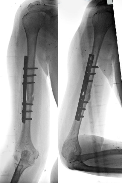 常规放射照片图片下载