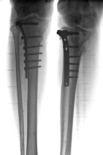 常规放射照片图片下载