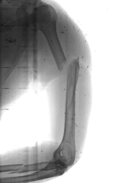 常规放射照片图片下载