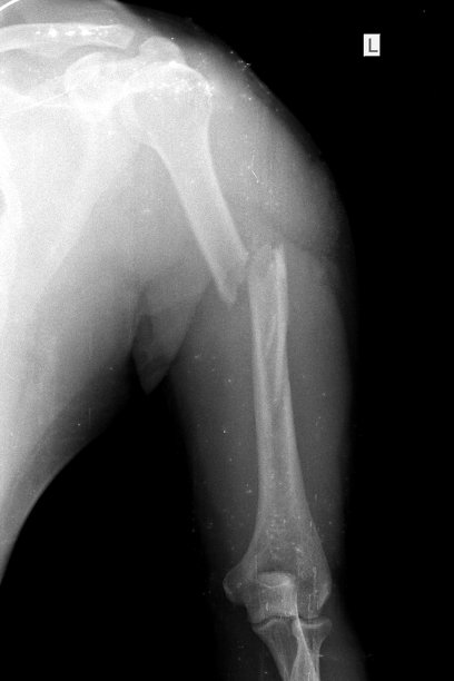 常规放射照片图片下载