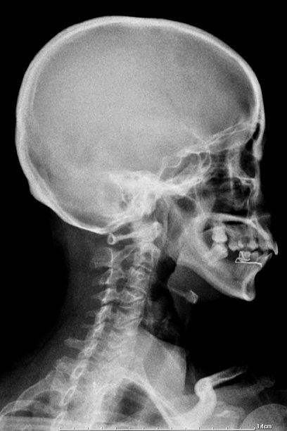 常规放射照片图片下载