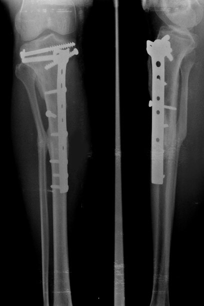 常规放射照片图片下载
