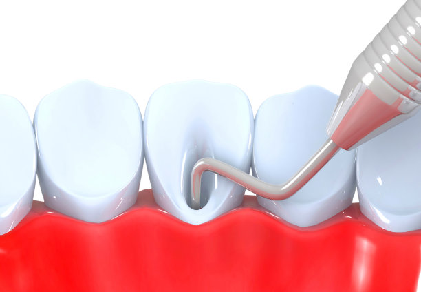 人类牙齿损伤解剖图片下载