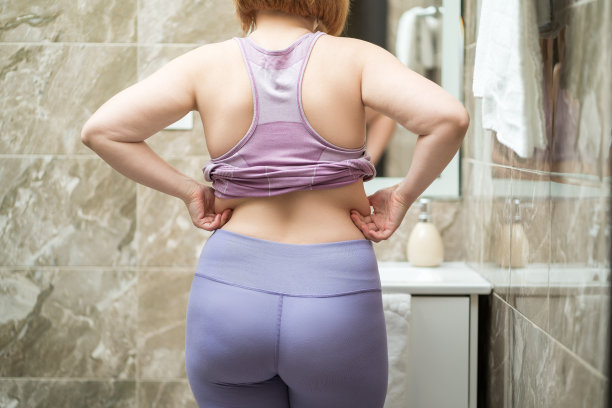 超重的女性背部，肥胖的身体上的皮肤褶皱图片下载