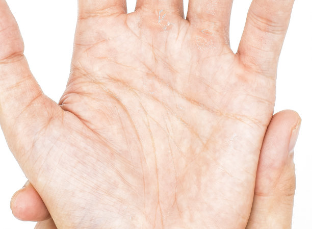 亚洲年轻人的汗津津的手掌。图片下载