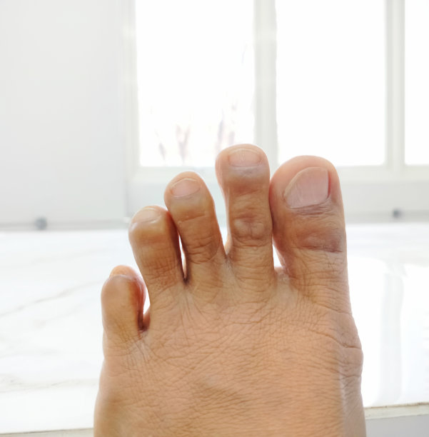 成年男性的指甲和脚趾图片下载