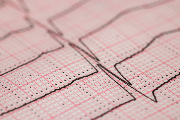 医生用它来分析心脏病的治疗方法。图片下载
