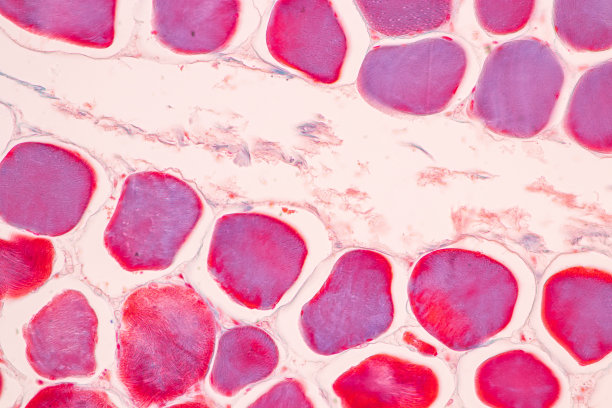 人体脂肪组织、软腭、骨骼和横纹肌。图片下载