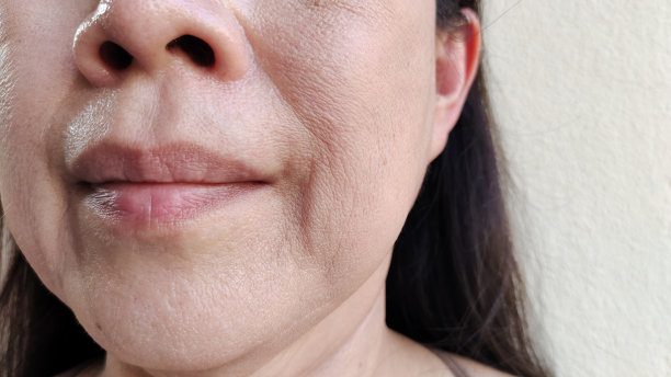 嘴巴旁边的皱纹和松弛的皮肤。图片下载