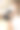 皮肤科医生为女子小腿做脱毛电解手术。在美容院的电子脱毛。垂直平面。真实的照片图片下载