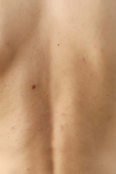 身体护理的概念与背部的年轻人图片下载