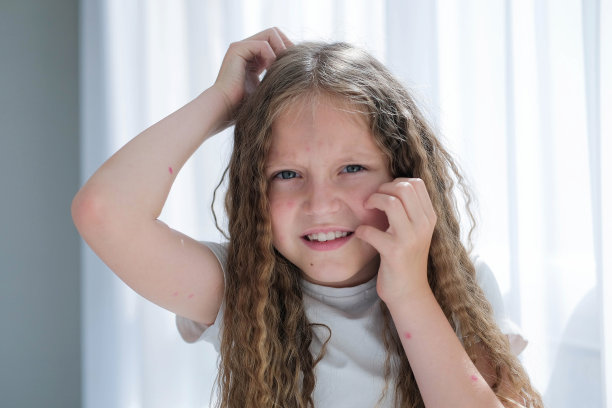 那孩子起疹子搔头。一个女孩因为水痘而发痒。图片下载