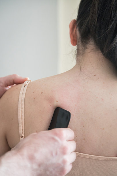 年轻的白人女性接受身体护理。治疗师正在做刮皮术。中医手法，瓜沙，止痛，治疗，活血。刺激疗法。图片下载