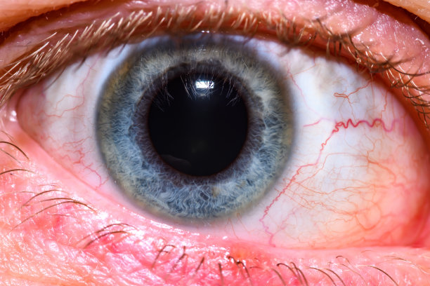 瞳孔放大的睁开的眼睛图片下载