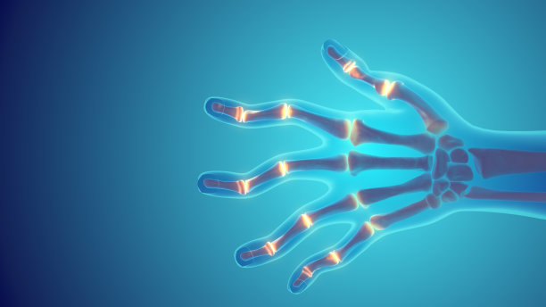 类风湿关节炎或自身免疫性和炎症性疾病图片下载