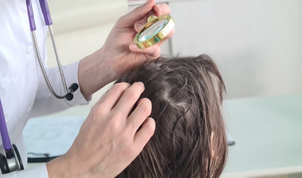 皮肤科医生会诊毛发学家通过放大镜检查女性头发图片下载