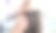 皮肤科医生会诊毛发学家通过放大镜检查女性头发图片下载