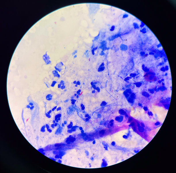 中央的红细胞结核分枝杆菌。图片下载