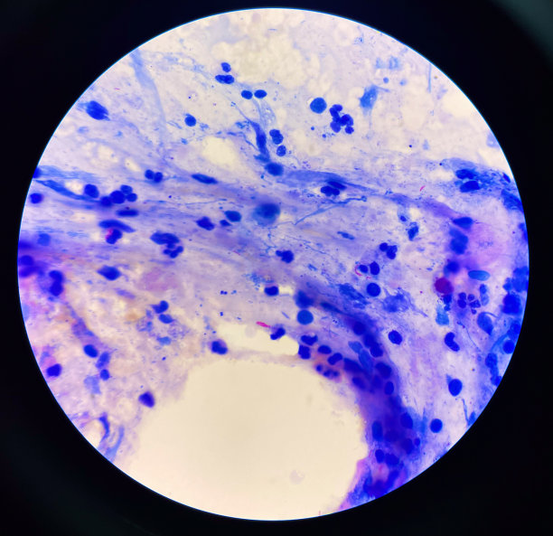 中央的红细胞结核分枝杆菌。图片下载