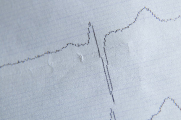纸上心电图作为背景微距照片图片下载