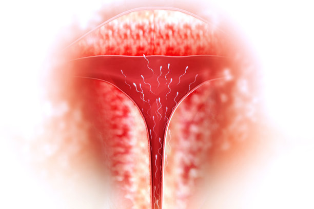 子宫内人工授精治疗。三维演示图片下载