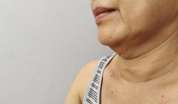 皮肤松弛、脂肪下垂、双下巴、颈部皮肤松弛。图片下载