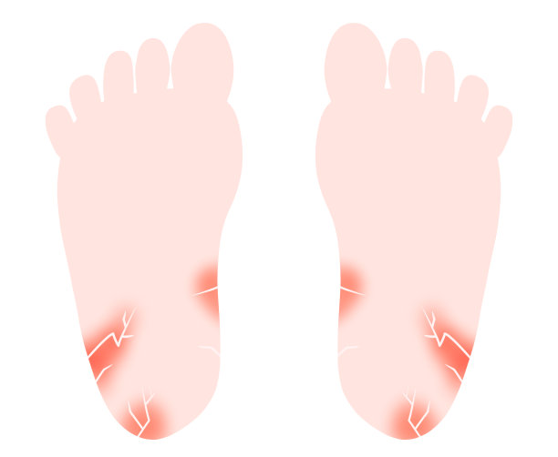 鞋底有划痕和裂缝的插图图片下载