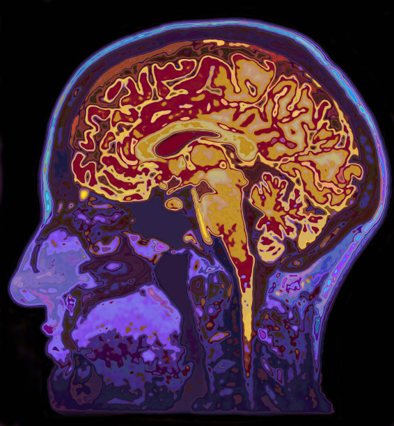 头部MRI图像显示大脑图片下载