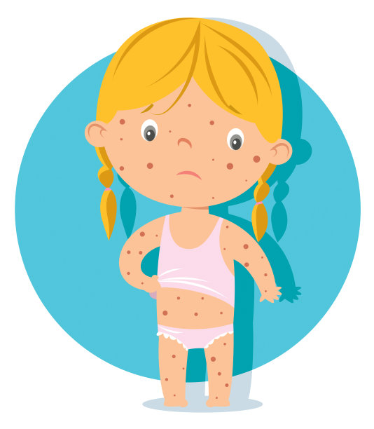 麻疹的孩子图片下载