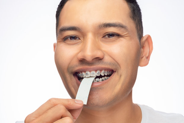 棕色皮肤的拉丁裔男子，用牙套咬了口香糖，误用了牙齿矫正图片下载