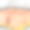 人的皮肤是有毛囊的层状表皮图片下载