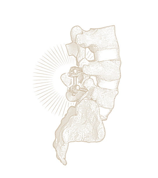 腰椎融合手术图片下载