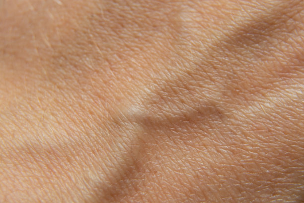 手掌上凸出的静脉作为背景特写图片下载