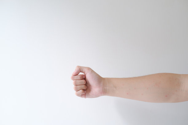 一只满是红点的手图片下载