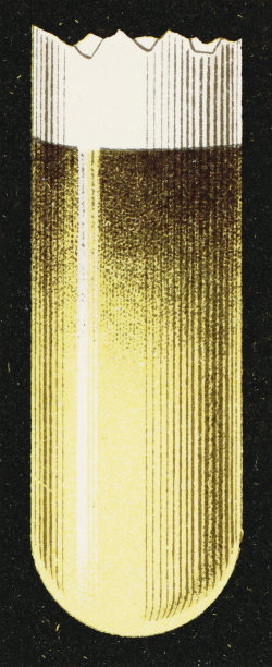 尼兰德的尿液还原糖测试——19世纪图片下载