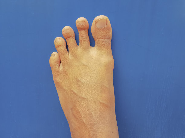 左脚踩在孤立的蓝色背景上图片下载