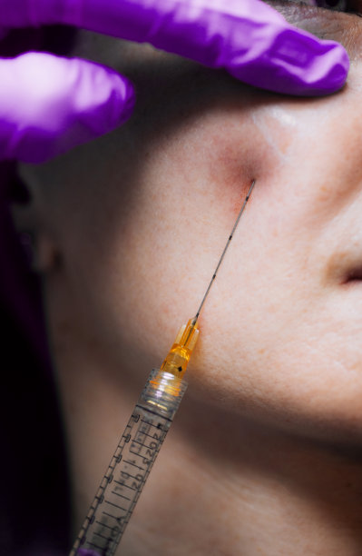 医生的手的特写给一个女人面部提升注射图片下载