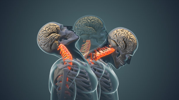 颈部疼痛或颈椎姿势综合征的医学动画图片下载