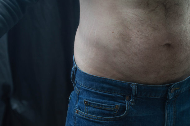 减肥后腹部脂肪会消失，皮肤上的妊娠纹也会消失图片下载