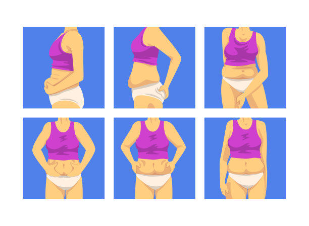 女性躯干下垂腹部和软肌肉向量集图片下载