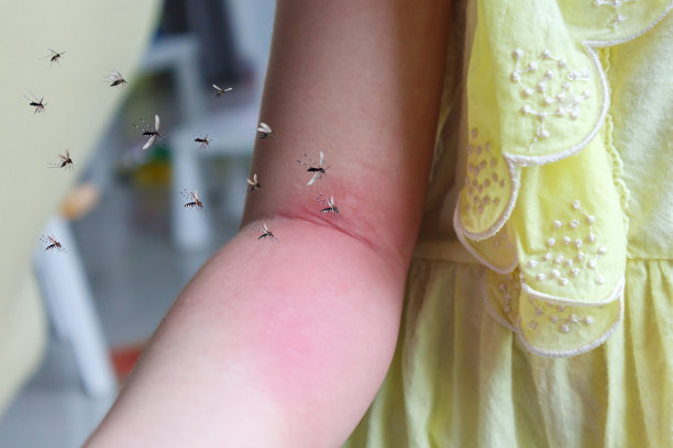 小女孩被蚊子咬伤，出现皮疹过敏和手臂发痒图片下载