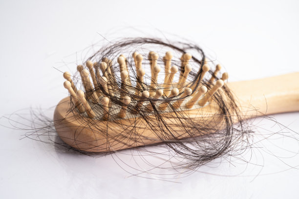 头发脱落严重影响梳子丛的健康、美容和美容理念。图片下载