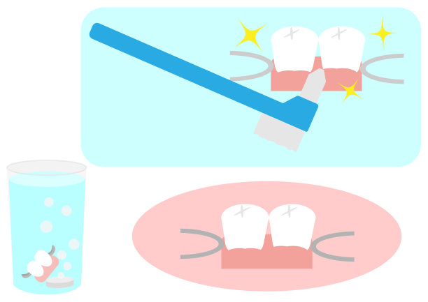 插图组可移动局部假牙图片下载