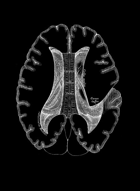 大脑的横截面图片下载