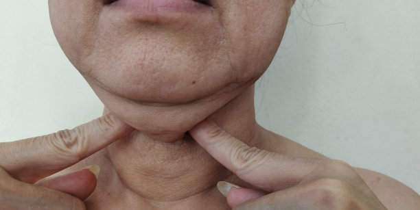 身体的松弛和皱纹，颈部以下的皮肤松弛和松弛。图片下载