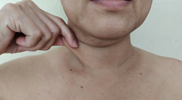 身体的松弛和皱纹，颈部以下的皮肤松弛和松弛。图片下载