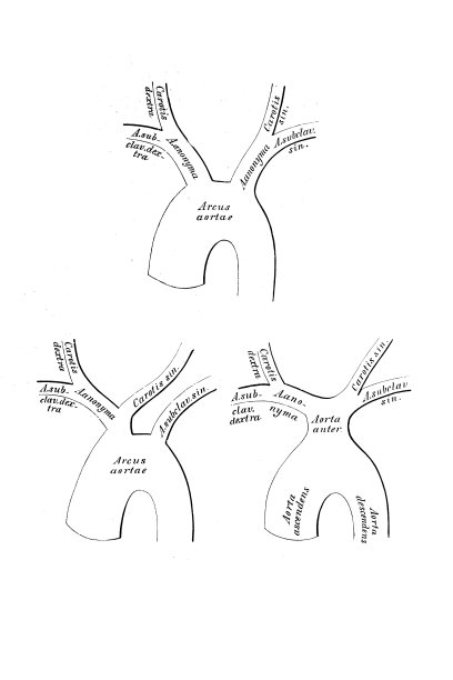 由主动脉弓缩小而产生的各种动脉的方案图片下载