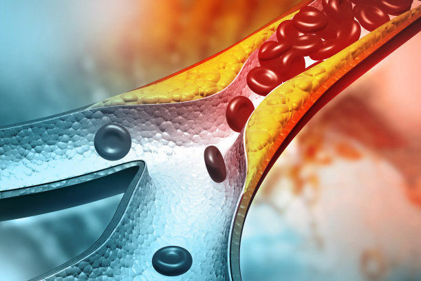 基于科学背景的动脉胆固醇斑块。三维演示图片下载